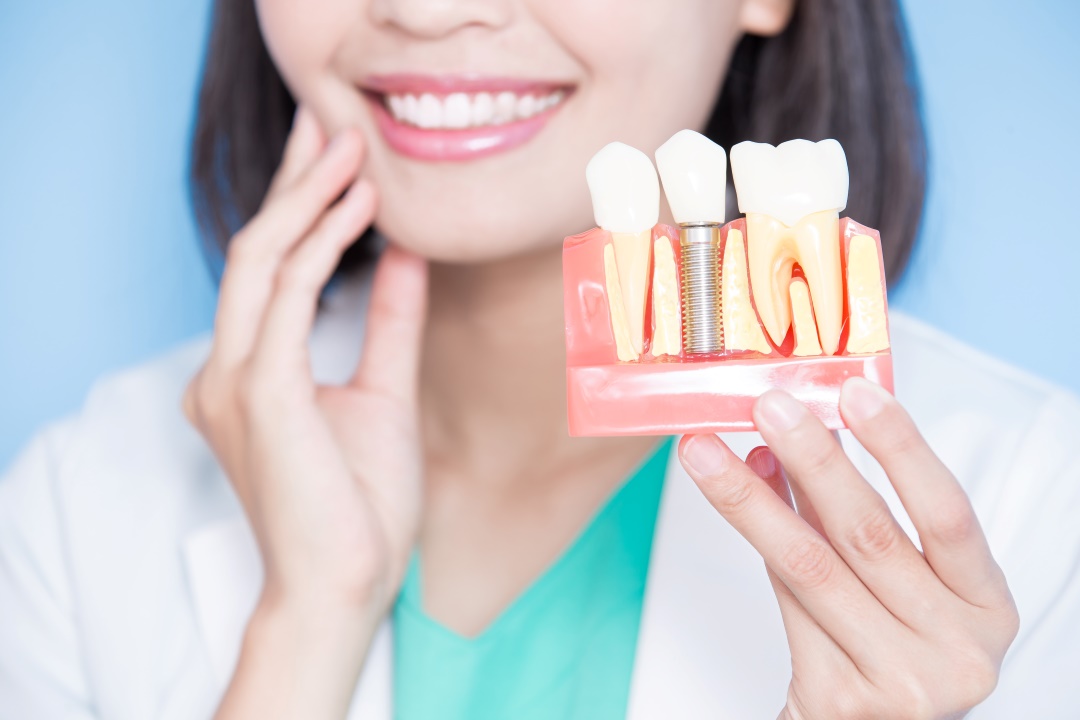 Dental Implants in Burlington